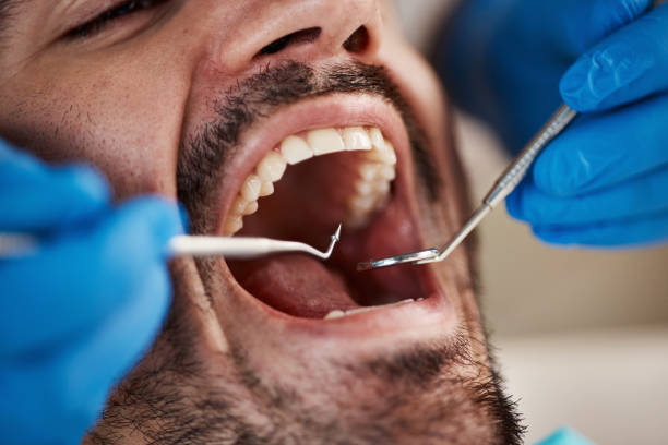 Emergency Dental Services in Tool, TX